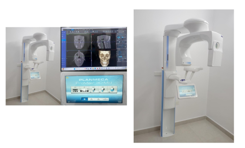PLANMECA-CBCT-Promax-3D